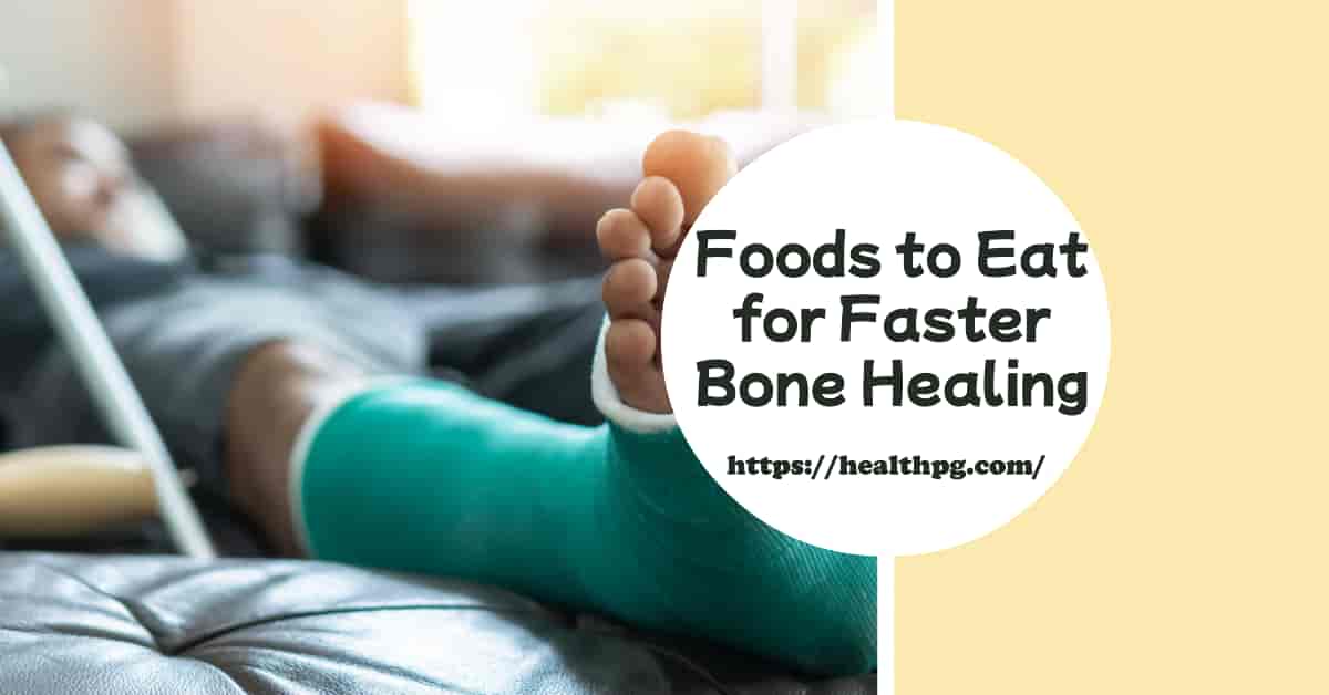 You are currently viewing What Foods Help Broken Bones Heal Faster (6 Best foods for bone recovery)