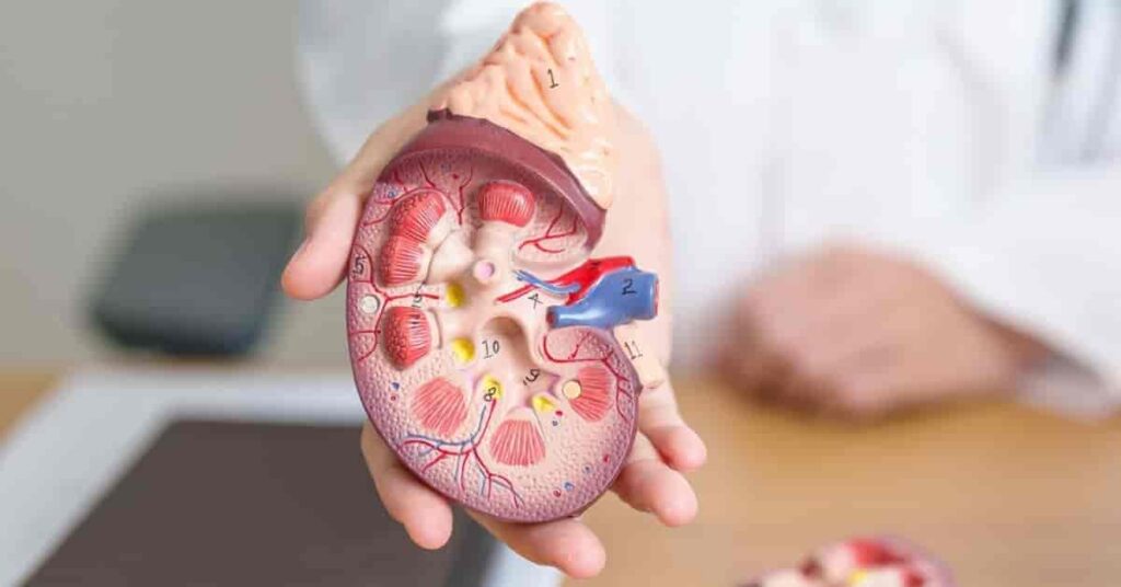 Foods to Avoid with High Creatinine Levels